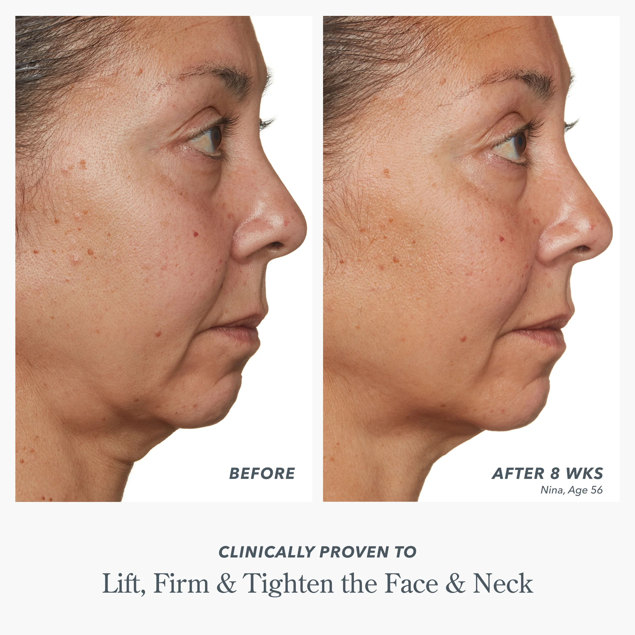 Milk Drops Ceramide Serum - Image 5