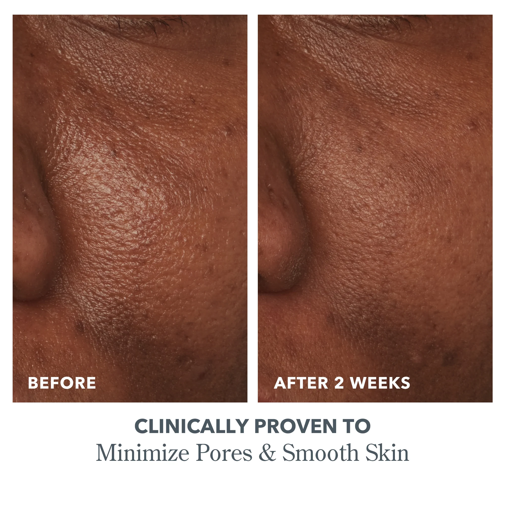 Potato Peel Rapid Resurfacing Milk Facial - Image 6