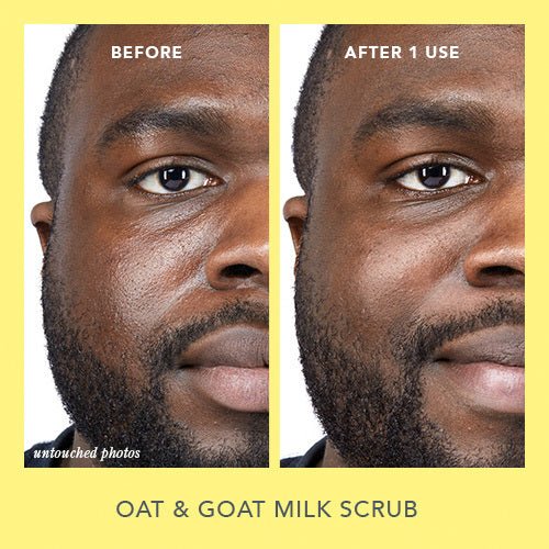 Spring Clean Your Routine Skincare Set - Image 11